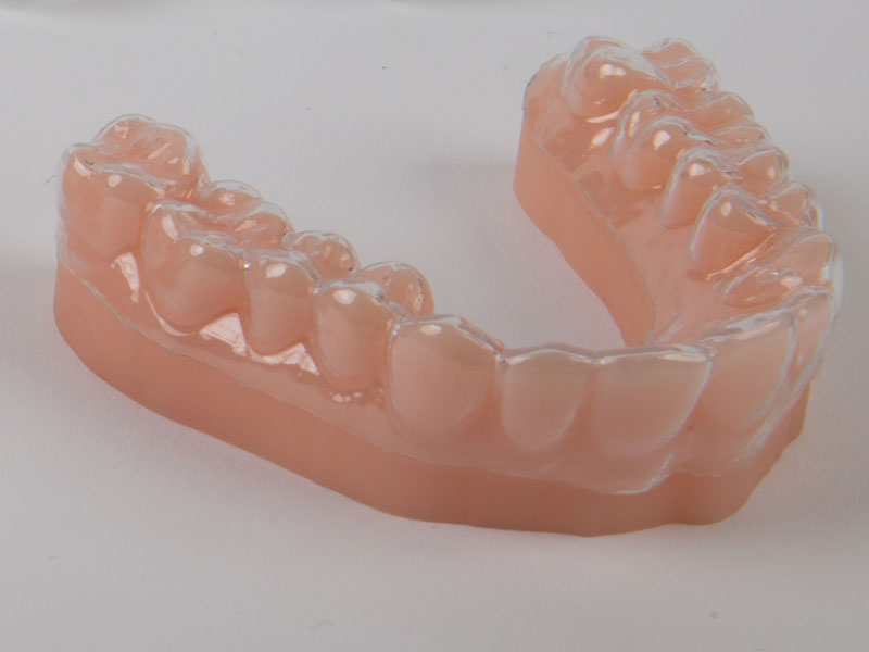 Impression-3D-modeles-dentaires-aligners-thermoformes