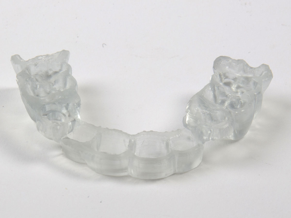 3D-printed-dental-surgical-guide-clear-200