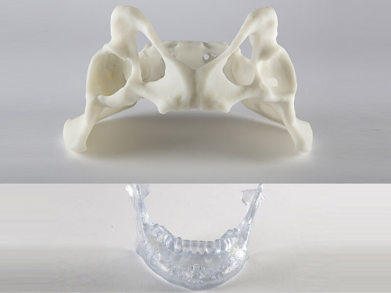 3d-printing-medical-3d-printed-surgical-guide