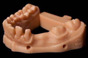 Dental-3D-printing-models-implants-orthodontic-production-Dreve